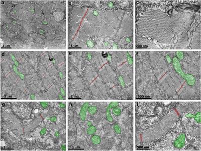 Simvastatin and Muscle: Zebrafish and Chicken Show that the Benefits are not Worth the Damage